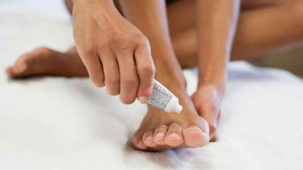 ketoconazole cream for toenail fungus